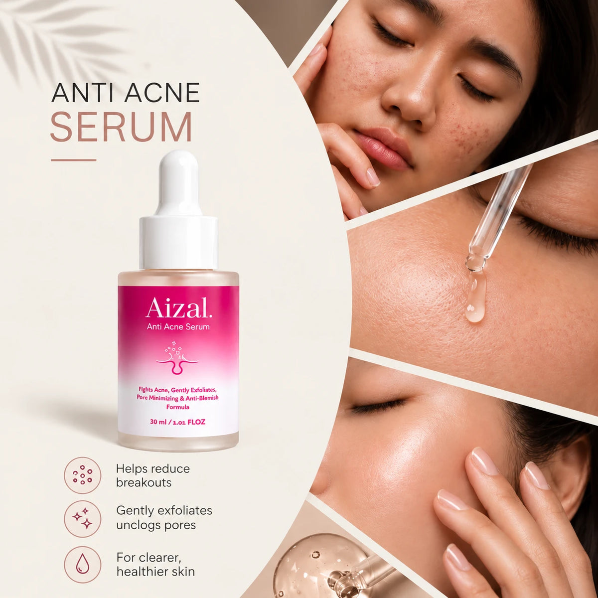 Anti Acne Serum in a dropper bottle