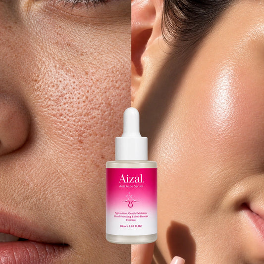 Anti Acne Serum 30ml Clear & Healthy-Looking Skin